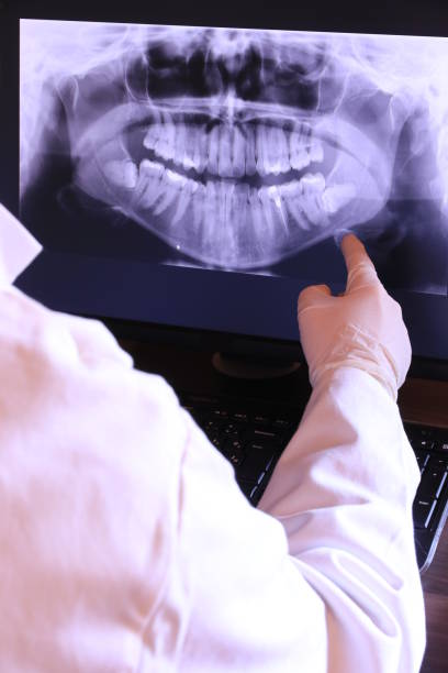 Best Emergency Dental Extractions in De Witt, NY